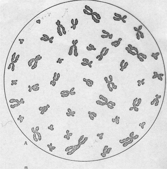 Karyotyp soubor chromozomů v jádře buňky Význam v genetickém