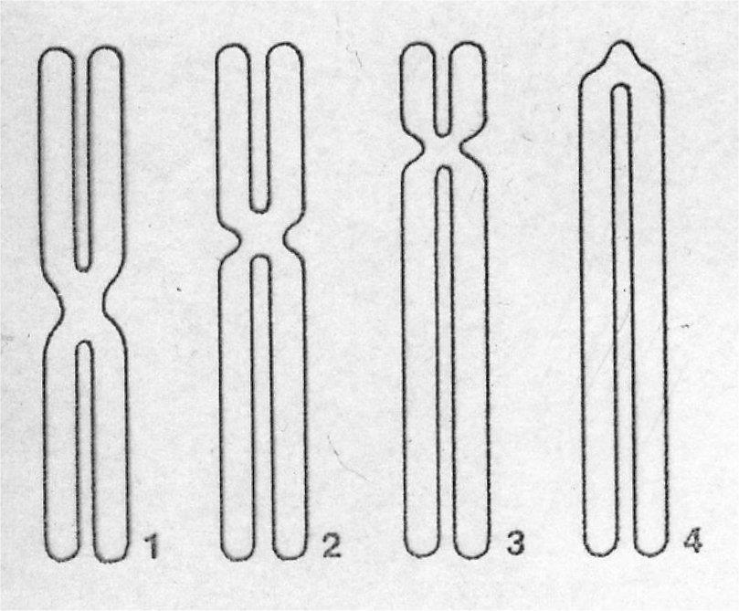 chromozomů 1965 technika vyšetření chromozomů z periferní krve - klasická technika barvení