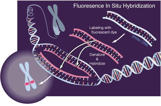 Současnost G-pruhy FISH (Fluorescenční in situ hybridizace)