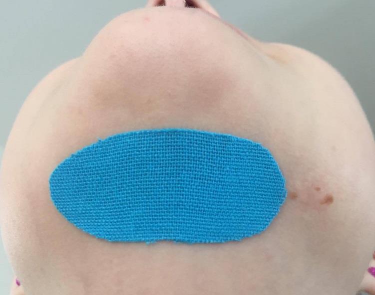 4.3 Popis pracoviště Obrázek 5: Kineziotaping jazylky Dětský rehabilitační stacionář Zvonek byl založen městem Kladno již v roce 1993.