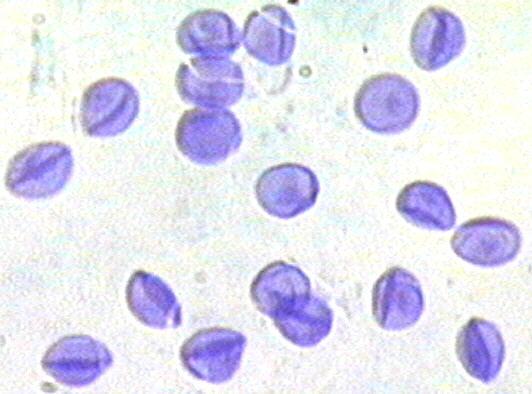 Třída Pneumocystidomycetes: opět monotypická skupina s jediným rodem Pneumocystis, kerý byl v minulosti považován za prvoka (Protozoa). Nemyceliální stélka.