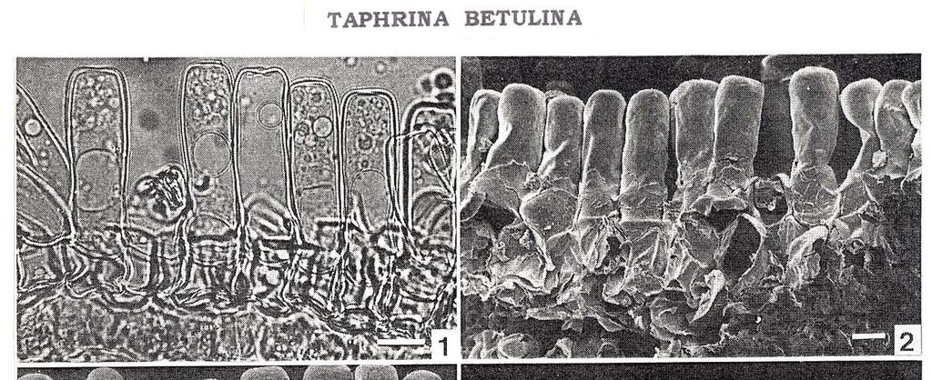 Taphrina betulina - vřecka symptomy