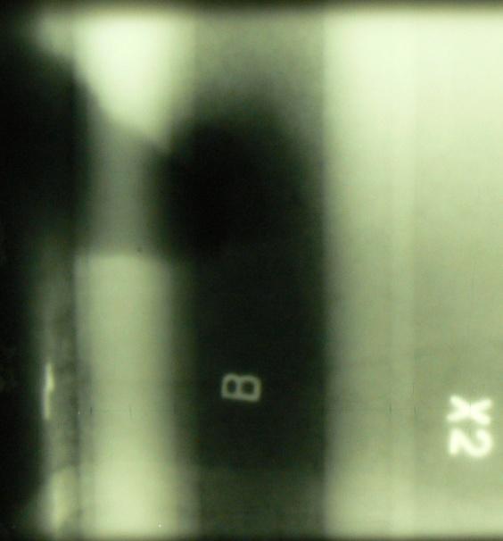 33: Radiogram průřezu R2, zářič umístěn nad bodem X2 Obr.