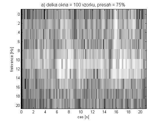 Postup základního zpracování signálu EEG tedy bude následující: 1) rozdělení signálu na segmenty o délce N tyto segmenty se často překrývají pro zlepšení časového rozlišení, 2) stanovení výkonového