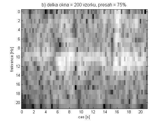 Pro toto zpracování signálu je třeba zvolit dva základní parametry: délku okna, ze kterého je každý bod spektrálního rozkladu počítán, a délku překryti sousedních oken.