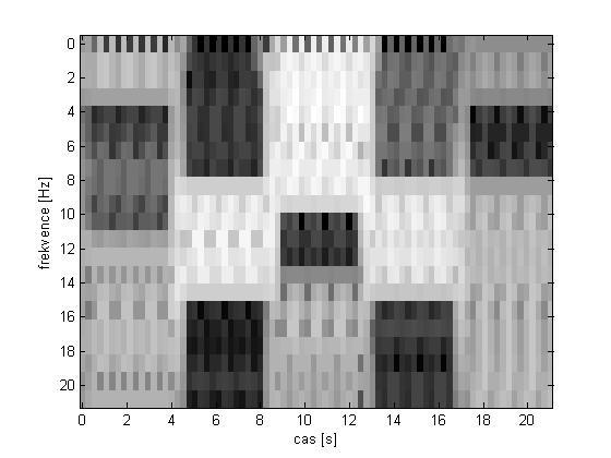 Na obrázku 7 je spektrogram simulovaného EEG signálu. Energie alfa (9-13 Hz) a delta (0.