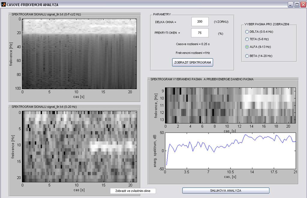 Okno pro zobrazení spektrogramu (0-Fvz/2 Hz) Tlačítko pro spuštění zobrazení
