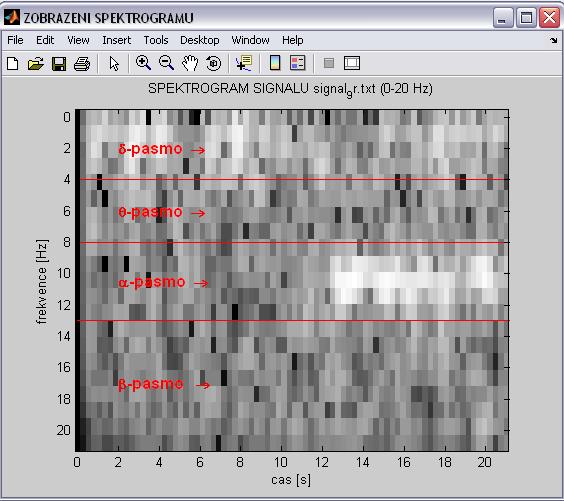 zobrazení Okno pro zobrazení spektrogramu (0-20 Hz) Vynořující se tlačítko