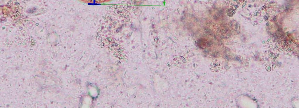 1: Vajíčka Hymenolepis nana Z 63 laboratoří