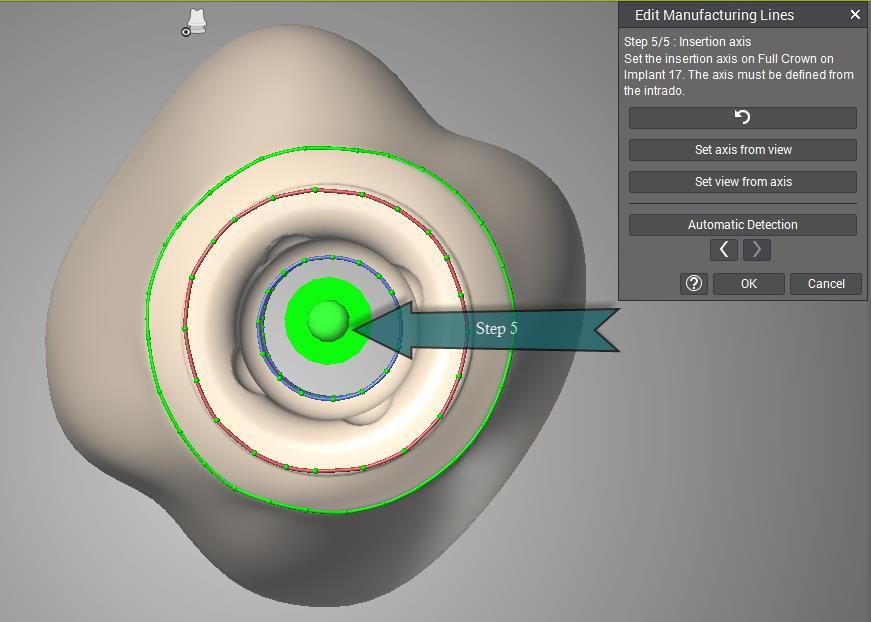 Úprava výrobních parametrů Krok 5/5 Osa nasazení: Nastavte osu nasazení korunky na implantátu. Osu musíte nastavit z vnitřní strany kavity.