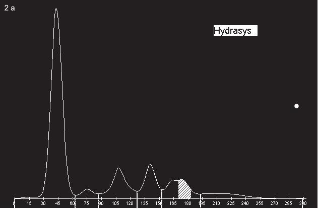 Fig. 1. Assessment of mutual differences between analyzers on the type of paraprotein using parallel coordinates plot and boxplots. Fig. 2.