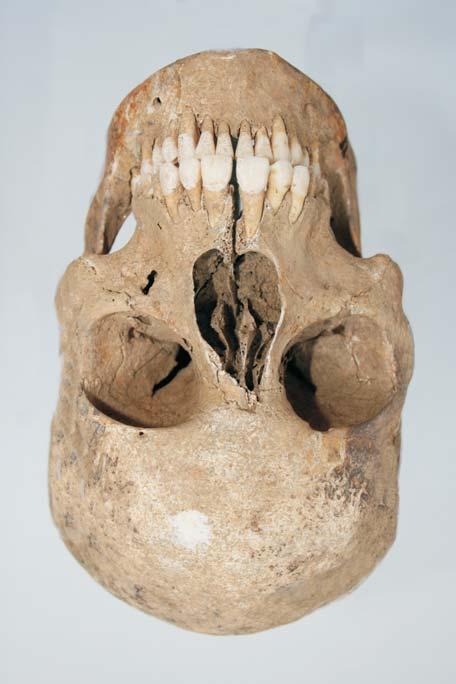 Obr. 9 1