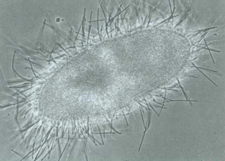 anorganický hrot buňka s vystřelenými trichocystami, ty ve vodě rychle bobtnají a vytváří