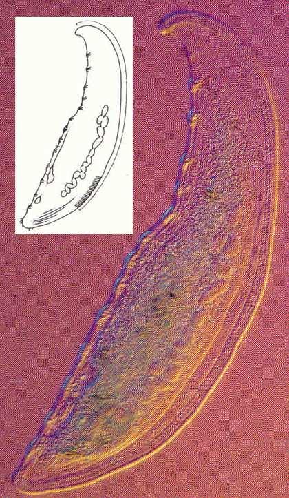 Loxophyllum sp.