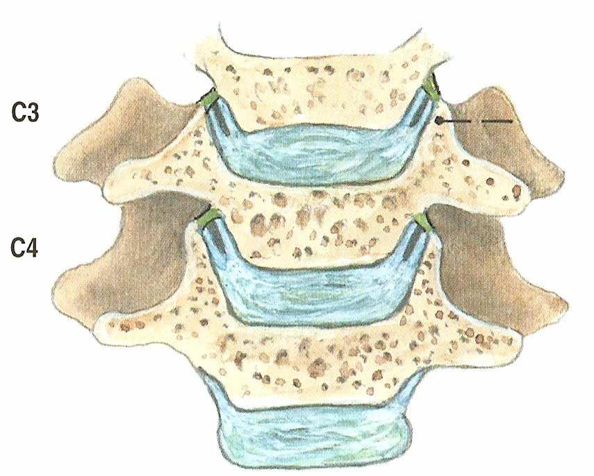 2.5 Meziobratlová destička Meziobratlový disk, nebo-li disci intervertebrales, zastává funkci spoje mezi těly obratlů.