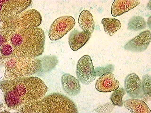 Mikrospory uvolněné z tetrád mikrospory mají exinu (vnější stěna tvořená