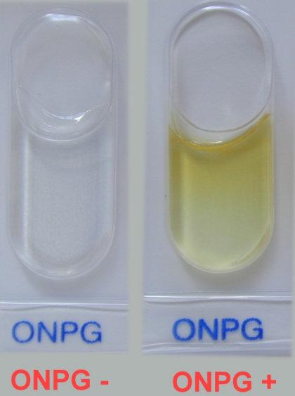 ONPG test produkce β-galaktozidázy bezbarvý