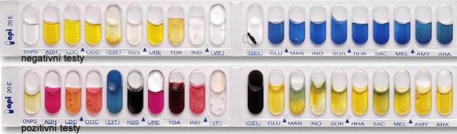 Standardizované testovací systémy rychlé zpracování velkého množství vzorků odstranění nesrovnalostí individuálními rozdíly v přípravě médií, provedení i hodnocení standard, diagnostické soupravy