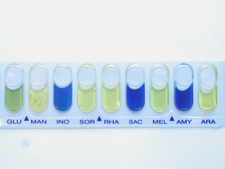 plynu) Shigella
