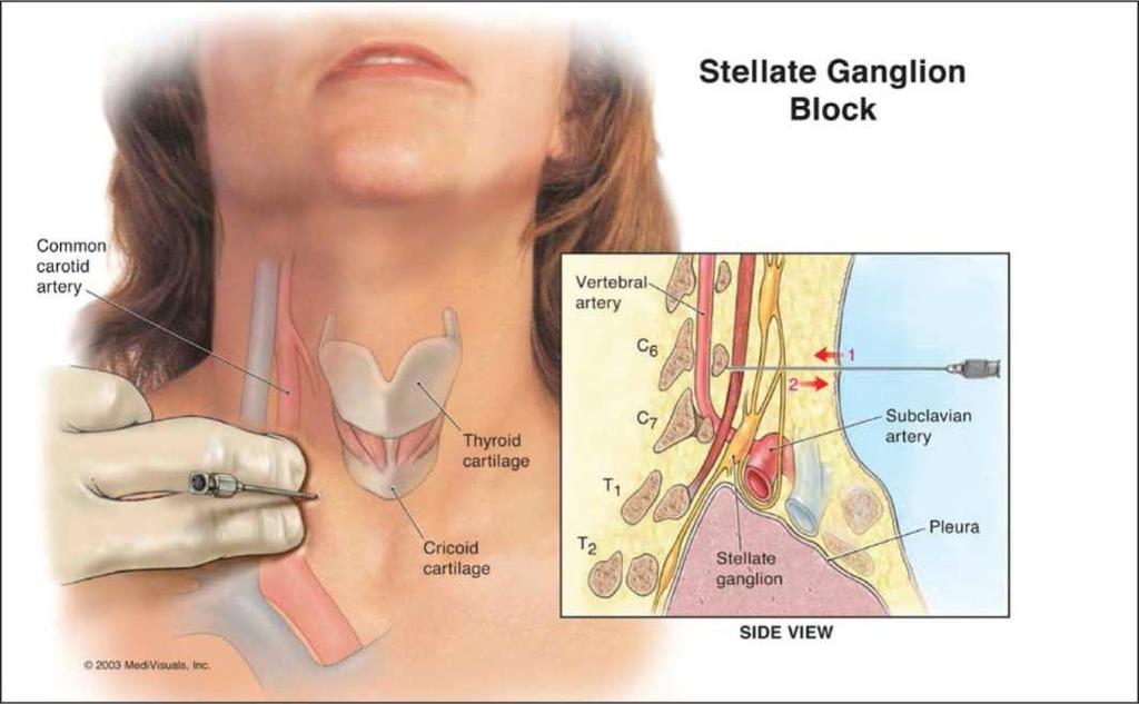 Ggl. stellatum Anagie, paliace - Anatomie -
