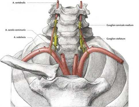 : Stellate Ganglion Block for the Treatment