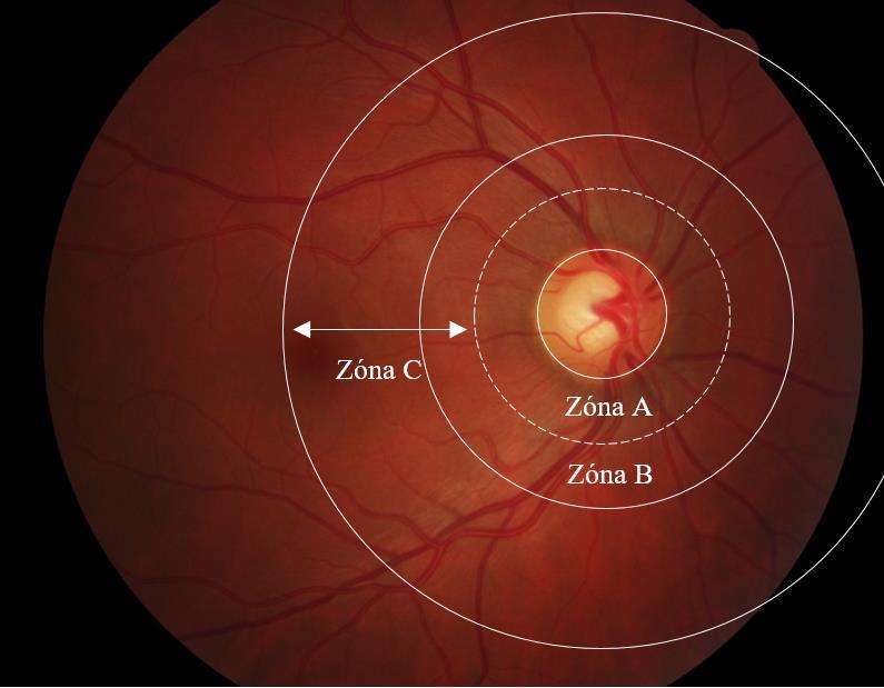 4 Pulzace cév sítnice Spontánní pulzace retinálních cév je jedním z důležitých klinických znaků zdravého člověka.