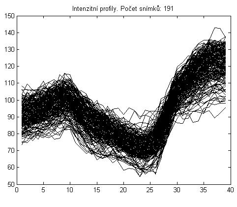 Obr. 25: Rozdíly v analýze