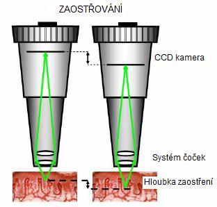 První metoda spočívá v měření tkáňových koncentrací substancí (s vyuţitím mikrodialýzy), jejichţ koncentrace se mění při hypoperfuzi.