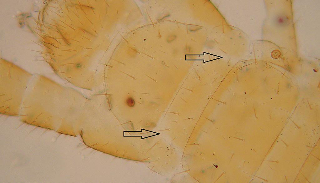 110 A c t a C a r p a t h i c a O c c i d e n t a l i s 6 T u f I. H. & K u p k a J. Fig. 2: Dorsal site of posterior part of body of male of Strigamia pusilla.
