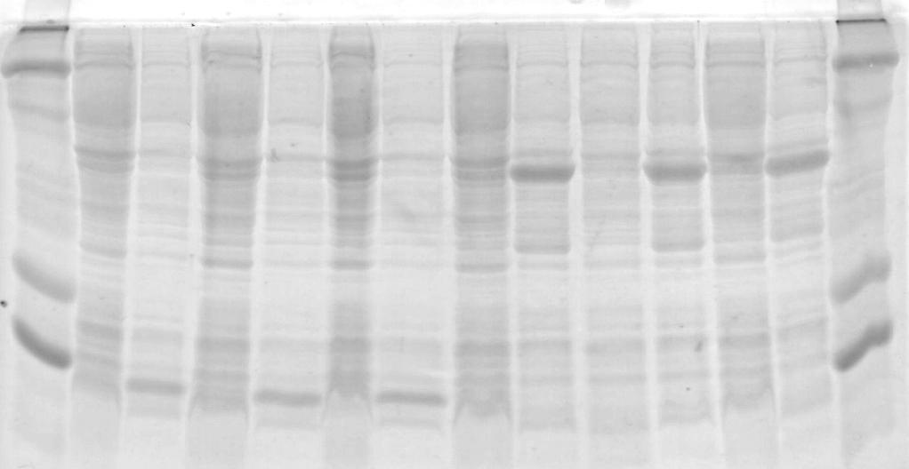 66 000 45 000 M I- I+ I- I+ I- I * + II- II+ II- II+ II- II+ M 18 400 14 300 Obr. 5: Selekce produkčního klonu. Dráha označená jako M představuje standard molekulových hmotností.