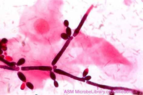 MOP VI (Gram) pathmicro.med.