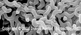 Salmonella typhi Tyčinky, tyčky rovné (většina bakterií,e.