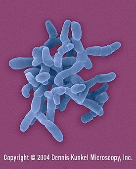 salmonella ) krátké (kokobacily) dlouhé - vlákna