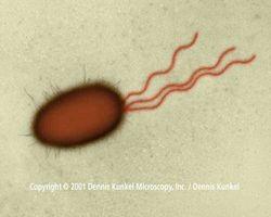 tuberculosisi, Clostridium tetani) robustní (r.