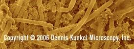 Campylobacter) Vibria různě prohnuté na jednu stranu,