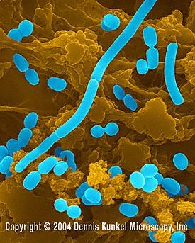 Bordetella pertusis, Kingella,