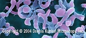 Další tvary tyčinek Mycelium tvořící aktinomycety, streptomycety Prostéky
