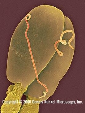 (Filomicrobium,Hyphomicrobium) Pupeny,pučení Pupeny na krátké straně.