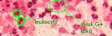 Mikroskopie ve vzorku mikroskopický