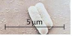 0,3 x 0,3 μm Bdellovibrio 0,8 x 0,3 Rickettsia