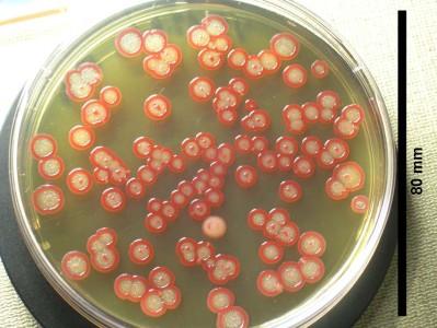 Serratia -