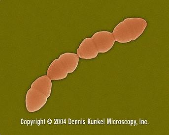 Gram-negative meningitis, Waterhouse-Friderichson syndrome Streptococcus pneumoniae - Gram-positive