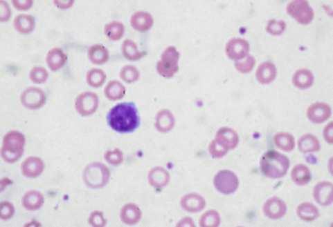Hematotoxické látky a) Toxická látka působí změnu ve