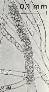 zoosporangium a zoospory Aplanes