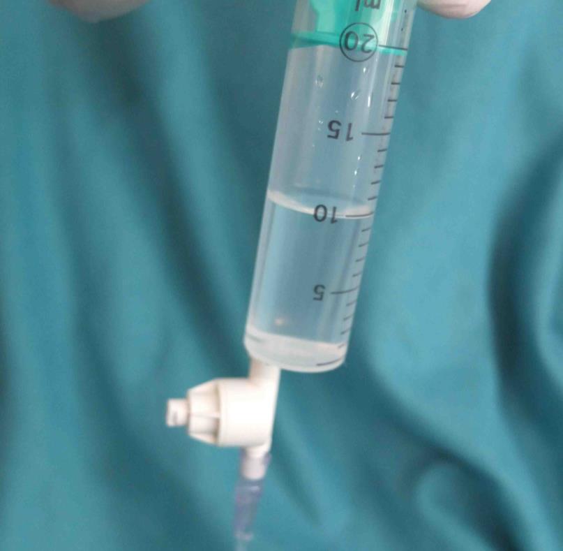 Technika ztlačeného vzduchu 15 psi Boyle-ho
