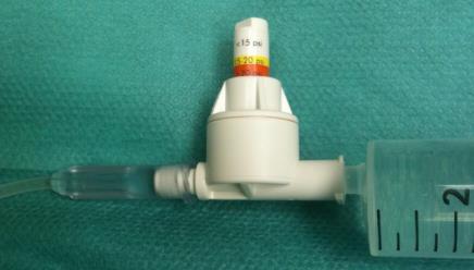 Běžná praxe? IS AN "INJECTION PRESSURE MONITOR" A USEFUL TOOL PERFORMING ULTRASOUND GUIDED PERIPHERAL NERVE BLOCKS? CLINICAL EXPERIENCES (PRELIMINARY RESULTS) U. Oberndorer 1, R. Cumlivski 1, S.