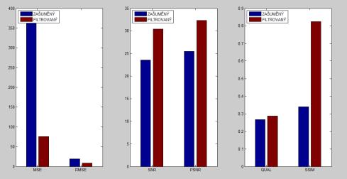 tabulce na Obr. 43. Jako srovnávací parametry pro kvalitu filtrace byly zvoleny parametry MSE (RMSE), SNR, PSNR, QUAL a SSIM.