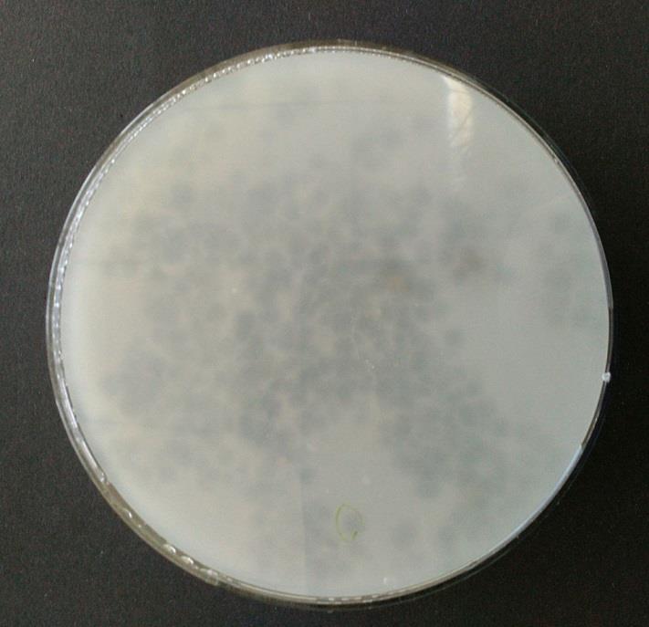 UTB ve Zlíně, Fakulta technologická 47 Obr. 7 - Kolonie s prosvětlenými zónami na kultivační půdě obsahující PBAT 8.4 Izolace čisté bakteriální kultury Abychom získali čistou kulturu, provádí se tzv.