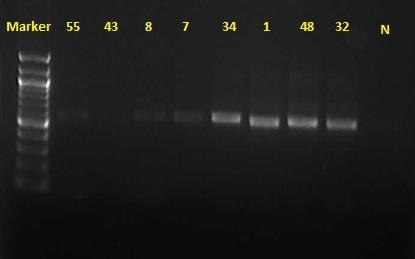 UTB ve Zlíně, Fakulta technologická 66 Provedená PCR reakce byla pro krátký úsek části genu 16S rrna se vzorky DNA z degradačních konsorcií izolovaných z půd 55, 43, 8, 7, 34, 1, 48, 32. Obr.