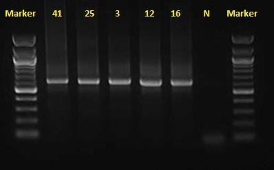 UTB ve Zlíně, Fakulta technologická 69 Byly zaznamenány výrazné amplikony ve všech sloupcích se vzorky templátové DNA konsorcií o očekávané délce 217 bp avšak došlo i k vzniku nespecifických produktů